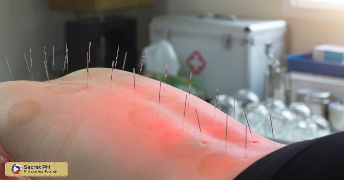 Abiera Acupuncture & Traditional Chinese Medicine Clinic